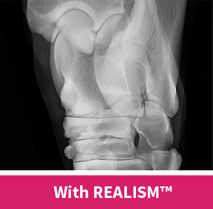 eq-realism